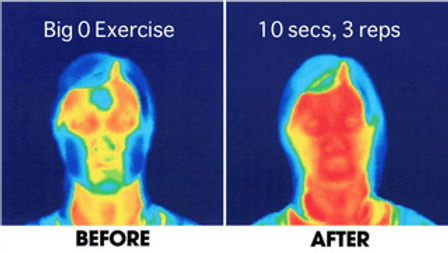 Are facial exercises effective?