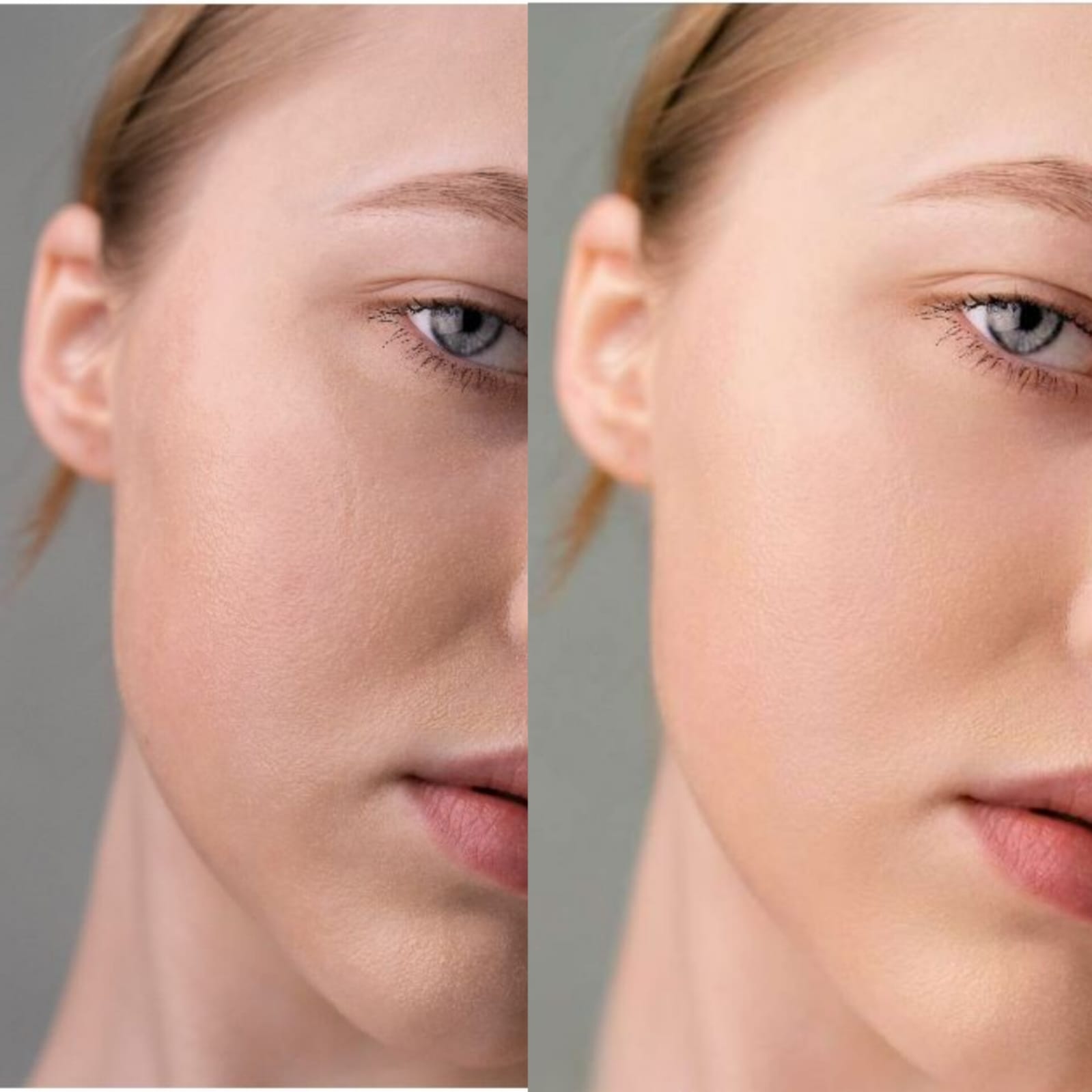 Before/After skin image