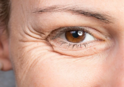 34763c_453e7e4e16d847718a73e8cd4ef8d1a5mv2-3